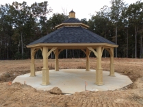 25' Custom Hexagon Gazebo